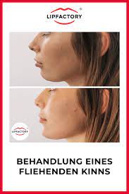 fliehendes kinn kinn jawline aufbau mit hyaluron kinn gesicht haut