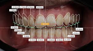 Digital Smile Designing