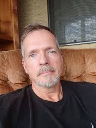 Should I get upper blepharoplasty at 54?