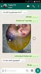 We did not find results for: Cara Menggugurkan Kandungan Secara Alami Dalam Hitungan Perjam Di Apotik Klinik Konsultasi