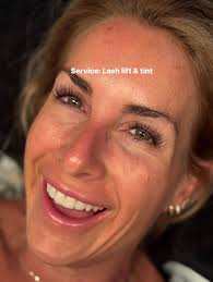 Esthetics With Katrina