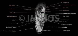 Muscles of the foot are located on its rear and on the sole. Anatomy Of The Foot And Ankle Mri