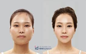 Check Out This Blog To Read More About Facial Contouring Facial Contouring Can Not Only Make You Look Much Mor Face Surgery Plastic Surgery Facial Contouring