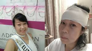 Beauty queen injured in road accident