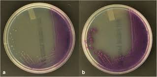 Haemolysin type i (lysing all types of washed erythrocytes) was the commonest one among all serovars except s. Chromogenic Media For The Detection Of Salmonella Enterica Serovar Paratyphi A In Human Stool Samples Evaluation In A Reference Setting Springerlink