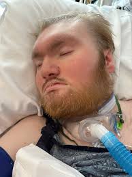 Can nerve surgery be successful years after a brachial plexus injury  accident?