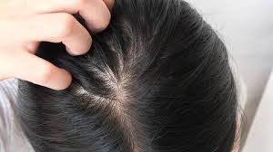 Read on to learn how it works & the potential side effects. What You Need To Know About Trying Minoxidil Treatments Hair Com By L Oreal