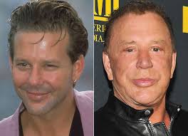 Mickey Rourke reaparece com rosto deformado após cirurgias plásticas em  pré-estreia em Nova York
