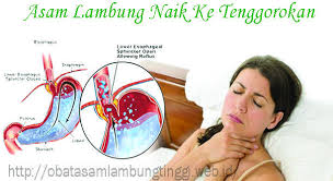 Obat Penurun Asam Lambung Naik Map Map Screenshot Supportive