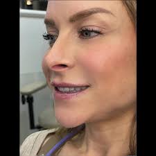 Biltmore Cosmetic & Restorative Dentistry Phoenix