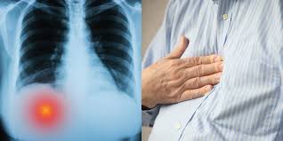 Check spelling or type a new query. Here S What It Means If You Have Pain Under You Right Rib Cage