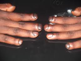 Image result for Digital Clubbing