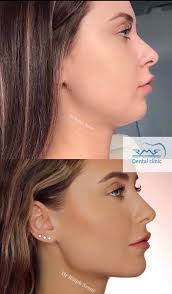 Dr Ralph Srour-RMS dental clinic