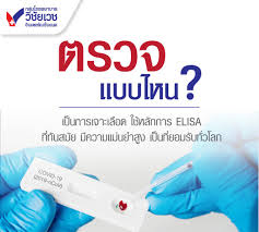 ตรวจภูมิคุ้มกันโควิด (covid19 antibody level test) เป็นการตรวจระดับภูมิทั้ง. Nho8l Cbmu3bim