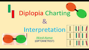 diplopia charting and interpretation