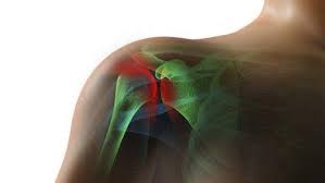 Image result for Fall on Shoulder