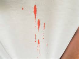 Effective tips on how to get blood out of sheets. How To Get Blood Out Of Sheets 7 Easy Methods Oh So Spotless