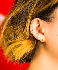 What Is A Keloid Piercing Hypertrophic Scars Explained