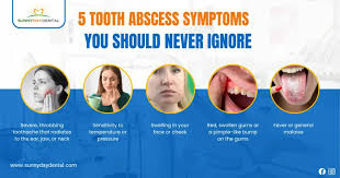 Image result for Periodontal Abscess