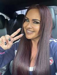 ShihTzu's Eye Ulcer Recovery Update