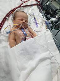 Aortic Stenosis: Harlow's Story - Tiny Tickers