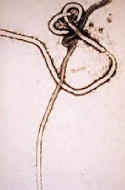 Aerosol transmission recognizes that the spraying of body fluids containing ebola virus directly onto mucous membranes is unlikely to occur in the absence of inhalation of infectious aerosols. Ebola Virus Infection Practice Essentials Background Pathophysiology And Etiology