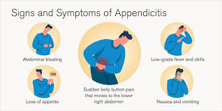 Image result for Appendicitis