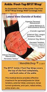 How To Heal Peroneal Tendonitis Peroneal Tendonitis Tendinitis Ankle Tendonitis