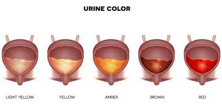 Normal Urine Color 50 Shades Of Yellow University Health