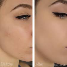 Christiaan Schodel On Instagram Hey Instafam So I Just Thought I Would Share With You Guys What A Difference A Good Skin Makeup Makeup Skin Care Best Primer