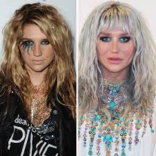 The latest media tweets from kesha rose news (@kesharosenews). The Beauty Evolution Of Kesha From Glitter Goddess To Hair Color Quee Teen Vogue