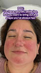 POV: You started with naturally petite lips… and now you’re rocking soft,  defined volume 💋✨, Sometimes all it takes is a little enhancement to bring  out the shape you’ve always had—now just more ...