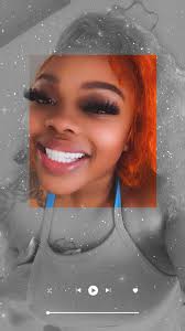 Porcelain Veneers at Miami Cosmetic Smile Design