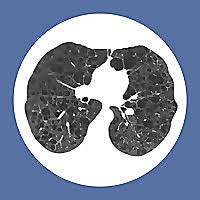 We achieve this mission by. Top 10 Pulmonology Blogs News Websites To Follow In 2021