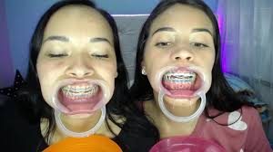 Latina braces fetish - ThisVid.com