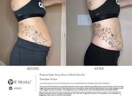 Pin On Before Afters
