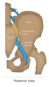 Is Your Sciatica Coming From Your Spine Or Your Si Joint Si Bone