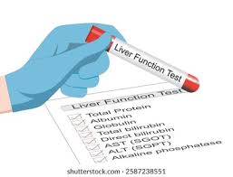 Image result for Liver Function Test