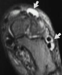Each test is specifically tailored to your needs. Mr Imaging Of The Ankle And Foot Radiographics