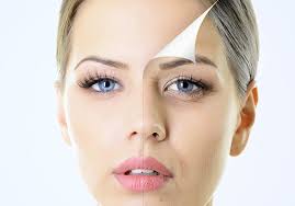 Learn how it's done, health risks, safety tips, and how to take care of your skin afterward. Blog Dermaroller Micro Needling Collagen Induction Therapy Find A Dermaroller Clinic In Canada Page 3