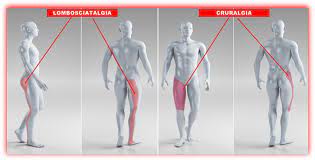 We did not find results for: Hernie VertebralÄ Èi Dureri Articulare Hernia De Disc Simptome Cauze Tratament