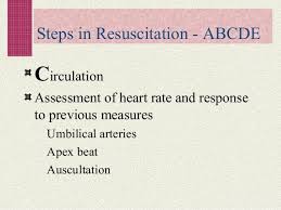 Image result for Neonatal Circulation Assessment
