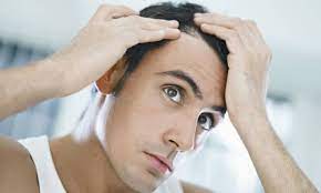 10 Best Haircuts And Hairstyles For Balding Men Too Manly