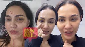 Crash Diet' Buat Nadia Brian Pening Kepala Sehingga Jatuh, Mata Pula  Terkena Kerusi