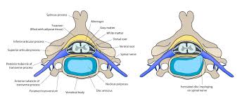 Pin On Back Pain