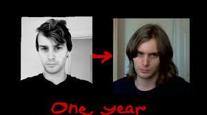 It begins in the papilla and can last from three to five years. Guy Growing Long Hair One Year Youtube
