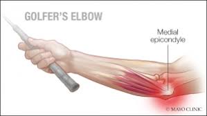 Chronic elbow injuries develop gradually over time and are caused by overuse. How To Treat Golfer S Elbow Pogo Physio Gold Coast