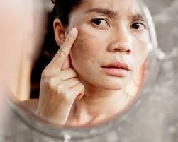 5 bước chống lão hóa đơn giản mà bất ngờ với sự cải thiện của làn da