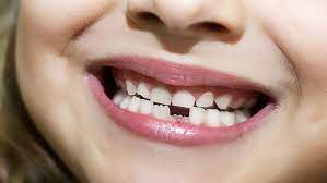 La chute des dents chez les personnes âgées n'est pas un processus naturel. Les Dents De Lait Magicmaman Com