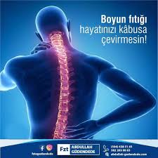 Boyun Fitigi Seviyesi Gore Boyun Omuz Kol Veparmaklarda Uyusma Yanma Karincalanma Ve Cekme Tarzinda Agri Olusturabilir Movie Posters Movies Poster